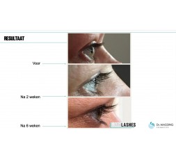 Dr. Massing Long Lashes Wimper Serum 3 ml.